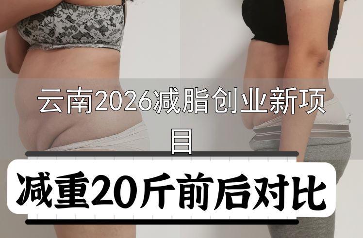 云南2026减脂创业新项目_靠谱厂家品牌_减肥项目类型