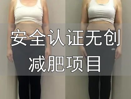 安全认证无创减肥项目_减肥产品国家认证_十大口碑减肥产品推荐